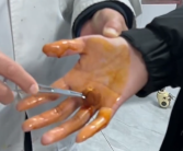 男子徒手摸灭火毯双手被刺钻心疼：主体材质玻璃纤维 需握黑色拉带 !