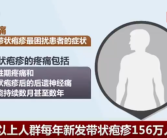 带状疱疹是最疼的皮肤病之一：超三分之一的人会患上!