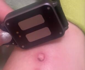 女生为考研戴电击手表叫起床被电伤：睡了12小时没被叫醒！