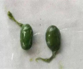 毒性胜过砒霜：2人轻信偏方生吞鱼胆致器官衰竭！