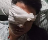 男子除夕夜遭烟花炸伤眼球被摘除：肇事者没找到！