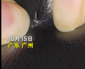 男子骑共享电车被车座上暗针所伤 官方回应！