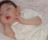 被医生断言活不过5岁 美国天生无脑女子创最长存活记录 !