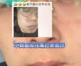 男子吃烧烤被烫出微笑唇：忽略了烤肉的铁签子温度高！