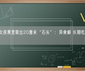 12岁女孩胃里取出20厘米“石头”：异食癖 长期吃头发导致！