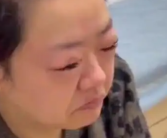 女子吃5斤车厘子过敏肿成悲伤蛙 医生提醒：过量食用所致！