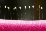 女子发现阳台上的衣架长出草蛉虫卵 究竟怎么回事