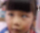 5岁女童沉迷玩手机变“斗鸡眼” 日均玩手机4至5小时 ！