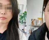 42岁女子20天断崖式衰老 前后判若两人！