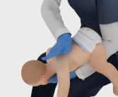 海姆立克急救法更新了：先拍5次背 再做“剪刀石头布” ！