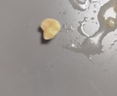 湾仔码头云吞吃出牙齿状异物 客服：双方仍在协商！