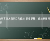 大爷洗鱼不慎水洒伤口险截肢 医生提醒：皮肤有破损勿接触海产品！