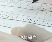 天下武功唯快不破！“95后”女技师凭“飞针”采血走红!